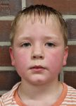 Meyer_Linus
